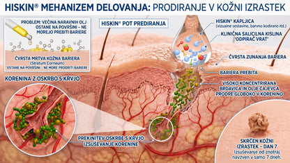 𝐇𝐢𝐬𝐤𝐢𝐧® 2-v-1 napredna negovalna krema za kožo – za nežno nego kožnih izrastkov, bradavic in vidnih kožnih nepravilnosti