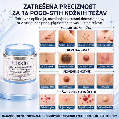 𝐇𝐢𝐬𝐤𝐢𝐧® 2-v-1 napredna negovalna krema za kožo – za nežno nego kožnih izrastkov, bradavic in vidnih kožnih nepravilnosti
